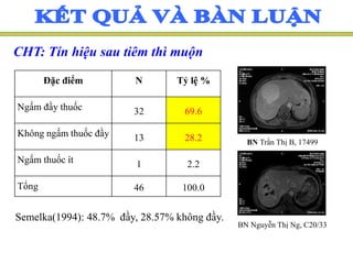 CHT: Tín hiệu sau tiêm thì muộn
BN Trần Thị B, 17499
Đặc điểm N Tỷ lệ %
Ngấm đầy thuốc 32 69.6
Không ngấm thuốc đầy 13 28.2
Ngấm thuốc ít 1 2.2
Tổng 46 100.0
BN Nguyễn Thị Ng, C20/33
Semelka(1994): 48.7% đầy, 28.57% không đầy.
 