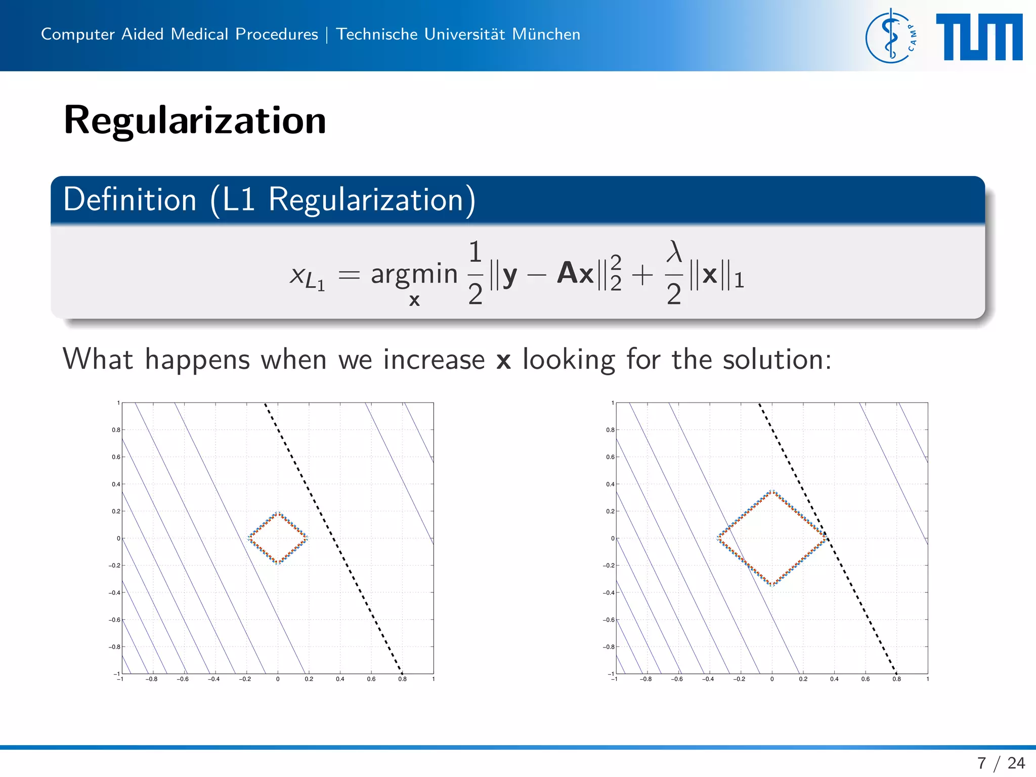 Computer Aided Medical Procedures | Technische Universität München
Regularization
Deﬁnition (L1 Regularization)
xL1 = argmin
x
1
2
y − Ax 2
2 +
λ
2
x 1
What happens when we increase x looking for the solution:
−1 −0.8 −0.6 −0.4 −0.2 0 0.2 0.4 0.6 0.8 1
−1
−0.8
−0.6
−0.4
−0.2
0
0.2
0.4
0.6
0.8
1
−1 −0.8 −0.6 −0.4 −0.2 0 0.2 0.4 0.6 0.8 1
−1
−0.8
−0.6
−0.4
−0.2
0
0.2
0.4
0.6
0.8
1
7 / 24
 