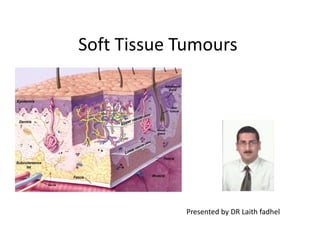 Soft Tissue Tumours
Presented by DR Laith fadhel
 