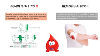 HEMOFILIA TIPO B HEMOFILIA TIPO C
Se debe a una deficiencia de factor IX. A pesar de la
diferencia en el factor de la coagulación implicado,
la hemofilia A y B es idéntica a nivel clínico.
La deficiencia de factor XI (o hemofilia C) suele ser
un trastorno leve, identificado por una hemorragia
postoperatoria prolongada
 