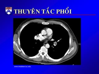 THUYEÂN TAÉC PHOÅI
www.meddean.luc.edu
 