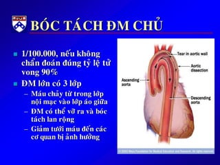 BOÙC TAÙCH ÑM CHUÛ
 1/100.000, neáu khoâng
chaån ñoaùn ñuùng tyû leä töû
vong 90%
 ÑM lôùn coù 3 lôùp
– Maùu chaûy töø trong lôùp
noäi maïc vaøo lôùp aùo giöõa
– ÑM coù theå vôõra vaø boùc
taùch lan roäng
– Giaûm töôùi maùu ñeán caùc
cô quan bòaûnh höôûng
 
