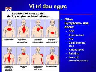 6
Vị trí đau ngực
 Other
Symptoms- Ask
about:
– SOB
– Diaphoresis
– N/V
– Cold/clammy
skin
– Palpitations
– Fainting
– Loss of
consciousness
 