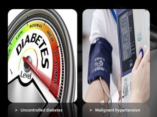  Uncontrolled diabetes  Malignant hypertension
 