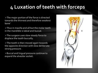 4 Luxation of teeth with forceps
The major portion of the force is directed
towards the thinnest and therefore weakest
bone’
Thus in maxilla and all but the molar teeth
in the mandible is labial and buccal.
The surgeon uses slow steady force to
displace the tooth buccally.
The tooth is then moved again towards
the opposite direction with slow deliberate
strong pressure .
Buccal and lingual pressure continue to
expand the alveolar socket.
 