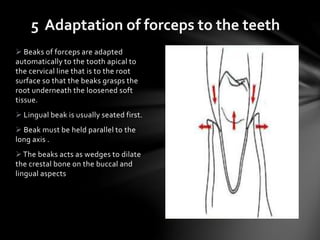 5 Adaptation of forceps to the teeth
 Beaks of forceps are adapted
automatically to the tooth apical to
the cervical line that is to the root
surface so that the beaks grasps the
root underneath the loosened soft
tissue.
 Lingual beak is usually seated first.
 Beak must be held parallel to the
long axis .
The beaks acts as wedges to dilate
the crestal bone on the buccal and
lingual aspects
 