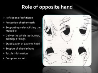  Reflection of soft tissue
 Protection of other teeth
 Supporting and stabilizing the
mandible
 Deliver the whole tooth, root,
dislodged fillings.
 Stabilization of patients head
 Support of alveolar bone
 Tactile information
 Compress socket
Role of opposite hand
 