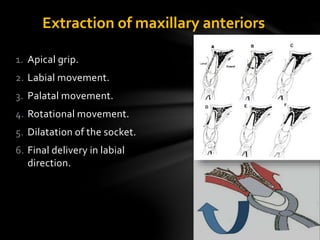 1. Apical grip.
2. Labial movement.
3. Palatal movement.
4. Rotational movement.
5. Dilatation of the socket.
6. Final delivery in labial
direction.
Extraction of maxillary anteriors
 