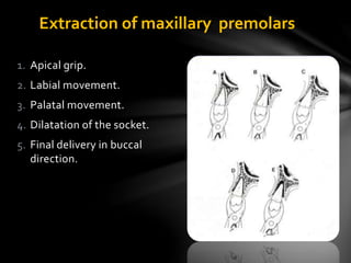 Extraction of maxillary premolars
1. Apical grip.
2. Labial movement.
3. Palatal movement.
4. Dilatation of the socket.
5. Final delivery in buccal
direction.
 