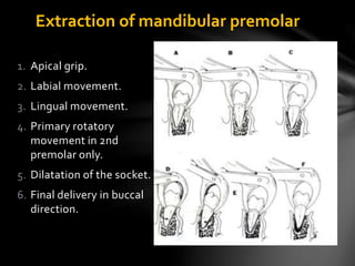 Extraction of mandibular premolar
1. Apical grip.
2. Labial movement.
3. Lingual movement.
4. Primary rotatory
movement in 2nd
premolar only.
5. Dilatation of the socket.
6. Final delivery in buccal
direction.
 