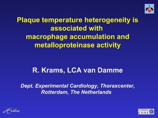 Plaque temperature heterogeneity is
associated with
macrophage accumulation and
metalloproteinase activity
R. Krams, LCA van Damme
Dept. Experimental Cardiology, Thoraxcenter,
Rotterdam, The Netherlands
 