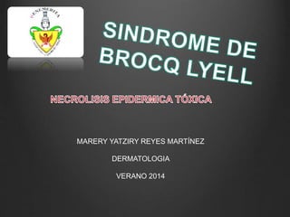 MARERY YATZIRY REYES MARTÍNEZ 
DERMATOLOGIA 
VERANO 2014 
 