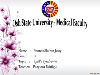 Name : Francis Sharon Jessy
Group : 12
Topic : Lyell’s Syndrome
Teacher: Pazylova Baktigul
 