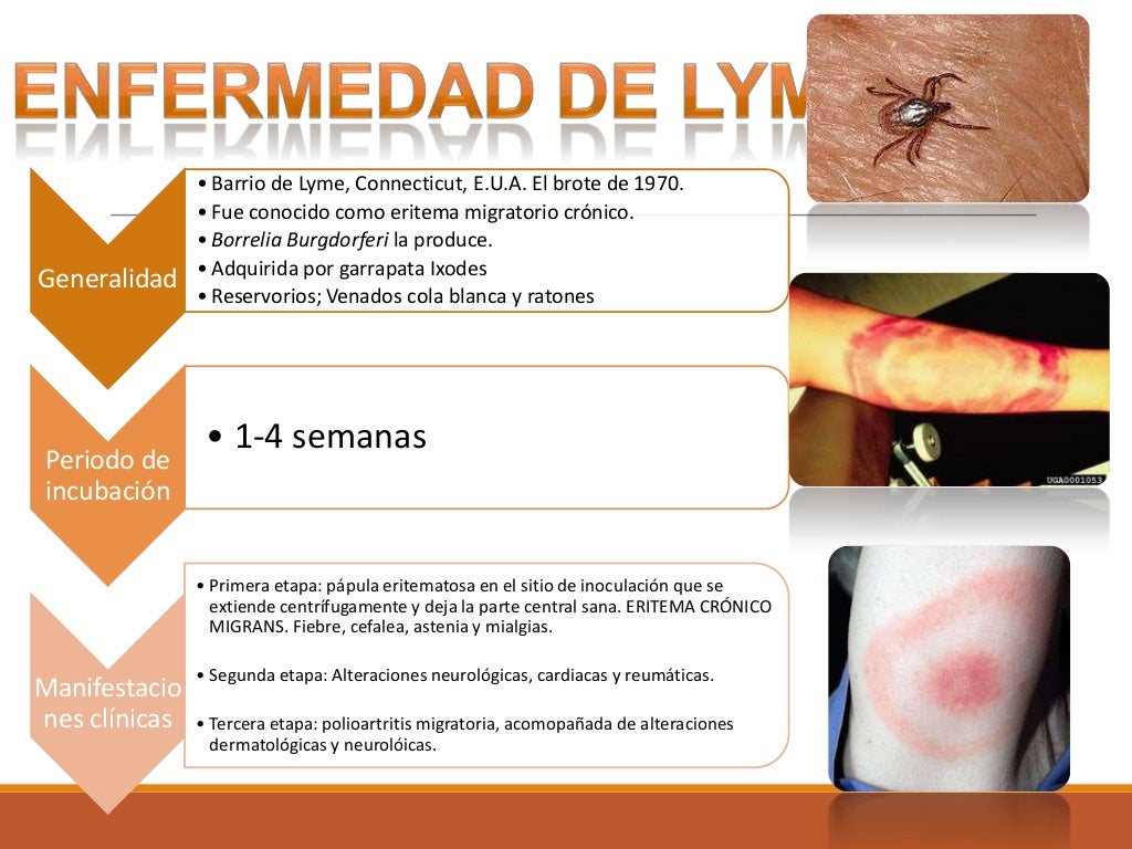 Enfermedad de Lyme Enfermedad de Lyme