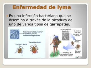 Enfermedad de lyme
 Es una infección bacteriana que se
disemina a través de la picadura de
uno de varios tipos de garrapatas.
 