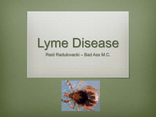 Lyme Disease
 Reid Radulovacki – Bad Ass M.C.
 