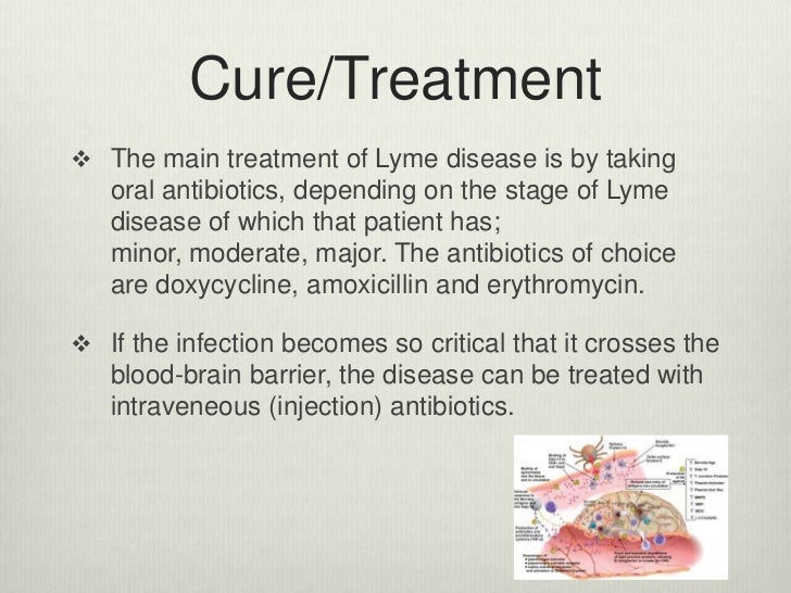 Lyme disease232424232