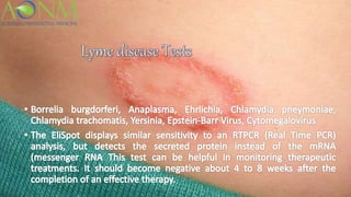 Lyme disease Testing | PPTX
