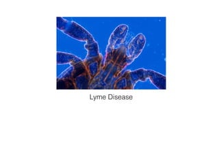 Lyme Disease
 