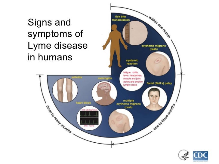 Lyme Disease Information