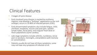 Clinical Features
• 3 stages of Lyme disease
• Early localized Lyme disease is marked by erythema
migrans; may develop a "bullseye" appearance as the rash
enlarges; occurs in 70-80% of infected persons (CDC).
• Early disseminated symptoms also include fatigue, chills
and fever, headache, muscle and joint pain, swollen
lymph nodes, facial palsy, and irregular heart beat or
heart palpitations (Lyme carditis).
• Late stage symptoms include arthritis, numbness, nerve
pain or paralysis, meningitis, and problems with memory
or concentration.
• Patients usually do not have all these symptoms, some
may not have any symptoms of infection at all.
 