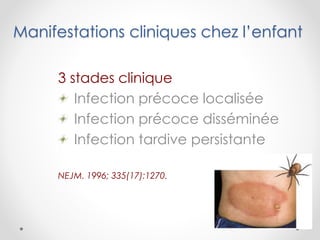 Manifestations cliniques chez l’enfant
3 stades clinique
Infection précoce localisée
Infection précoce disséminée
Infection tardive persistante
NEJM. 1996; 335(17):1270.
 