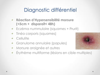 Diagnostic différentiel
Réaction d’Hypersensibilité morsure
(<5cm + disparaît< 48h)
Eczéma nummulaire (squames + Prurit)
Tinéa corporis (squames)
Cellulite
Granulome annulaire (papules)
Morsure araignée et autres
Érythème multiforme (lésions en cible multiples)
 