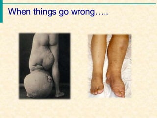 When things go wrong…..
 