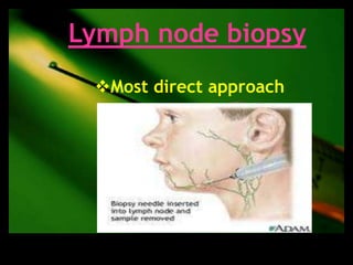 Lymph node biopsy
 Most direct approach
 