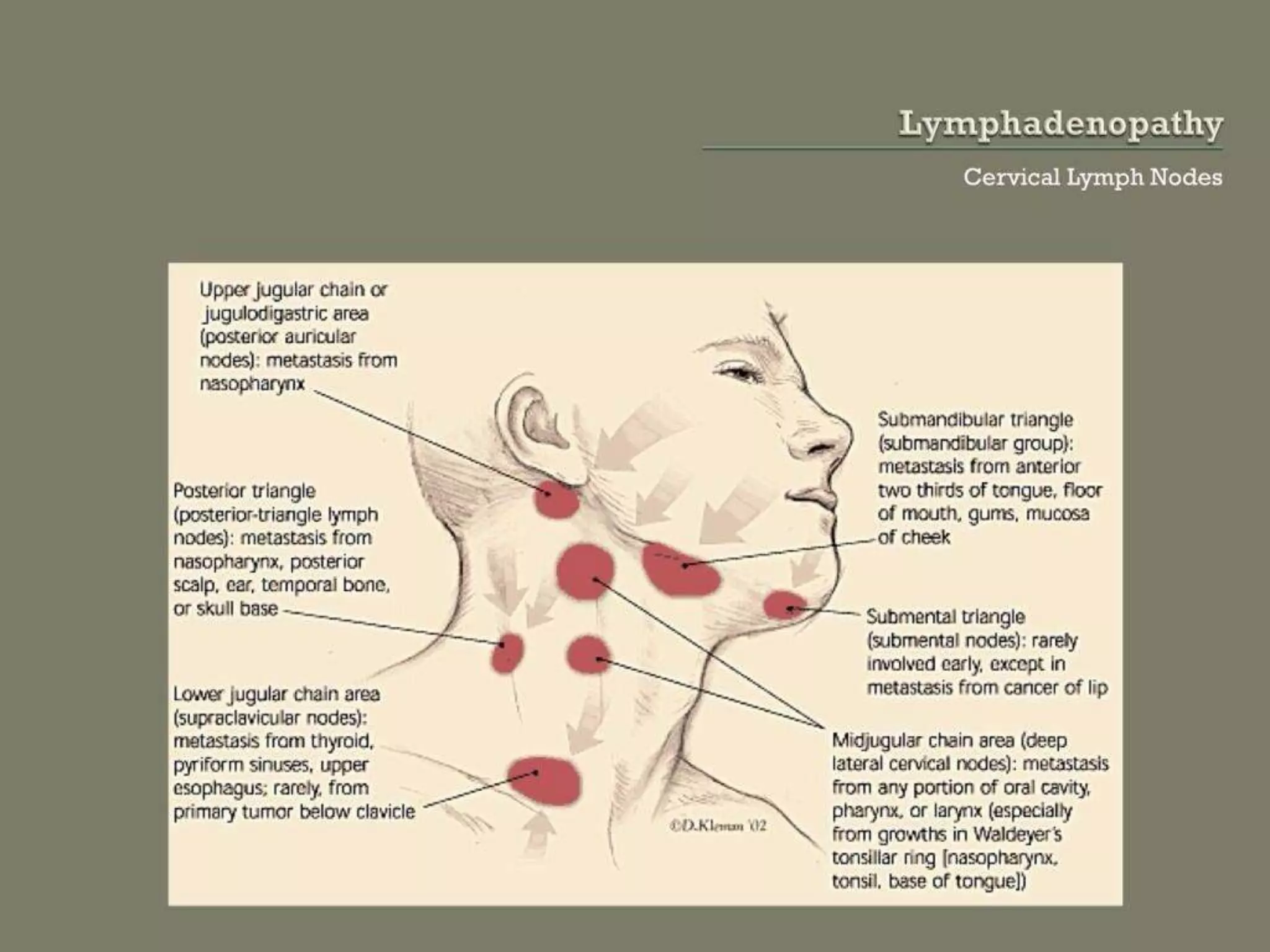 Lymphadenopathy PPTX
