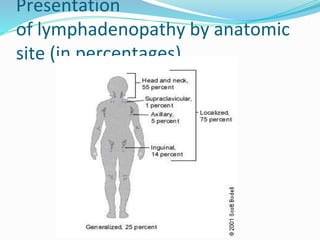 Presentation
of lymphadenopathy by anatomic
site (in percentages).
 