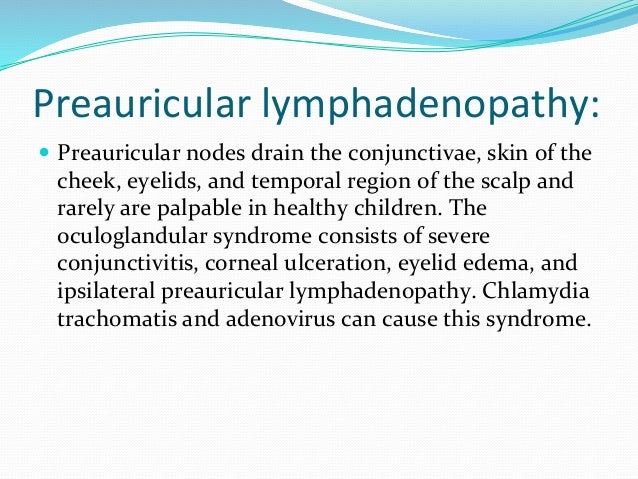47+ Swollen Preauricular Lymph Node Treatment Pictures