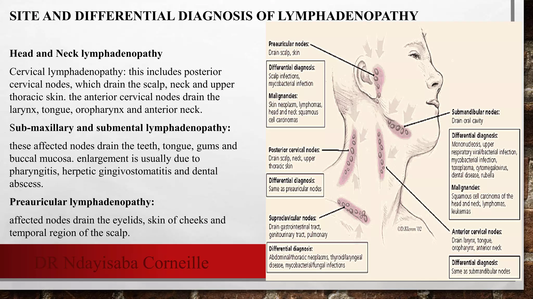 Lymphadenopathy PPTX