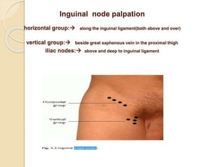 Inguinal node palpation
horizontal group: along the inguinal ligament(both above and over)
vertical group: beside great saphenous vein in the proximal thigh
iliac nodes: above and deep to inguinal ligament
 