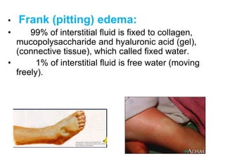 • Frank (pitting) edema:
• 99% of interstitial fluid is fixed to collagen,
mucopolysaccharide and hyaluronic acid (gel),
(connective tissue), which called fixed water.
• 1% of interstitial fluid is free water (moving
freely).
 