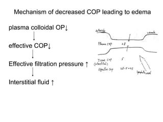 Mechanism of decreased COP leading to edema
plasma colloidal OP↓
effective COP↓
Effective filtration pressure ↑
Interstitial fluid ↑
 