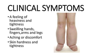 CLINICAL SYMPTOMS
•A feeling of
heaviness and
tightness
•Sweilling hands,
fingers,arms and legs
•Aching or discomfort
•Skin hardness and
tightness
 