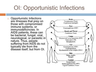 OI: Opportunistic InfectionsOpportunistic Infections are illnesses that prey on those with compromised immune systems, or immunodeficincies. In AIDS patients, these can be bacterial, fungal, viral, neurological, or parasitic in nature. Thus, people suffering from AIDS do not typically die from the disease itself, but from OI.