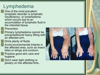 Lymphedema One of the most prevalent lymphatic disorder is lymphatic insufficiency, or lymphedema which occurs due to an accumulation of lymphatic fluid in the interstial tissue. Prevention Primary lymphedema cannot be preventedAvoid heavy lifting with an affected arm. Drink plenty of fluids Avoid environmental irritants in the affected area, such as insect bites or stings and sunburn. Practice good skin care and hygiene. Don't wear tight clothing or jewelry on the affected limb..   