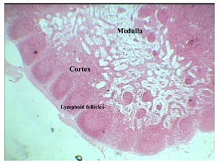 Cortex
Medulla
Lymphoid follicle↓
 