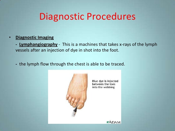 Lymphatic and immune presentation
