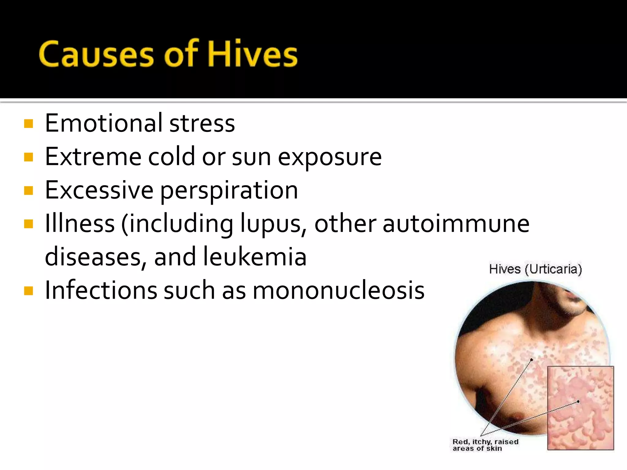 Causes of Hives Emotional stressExtreme cold or sun exposureExcessive perspirationIllness (including lupus, other autoimmune diseases, and leukemiaInfections such as mononucleosis