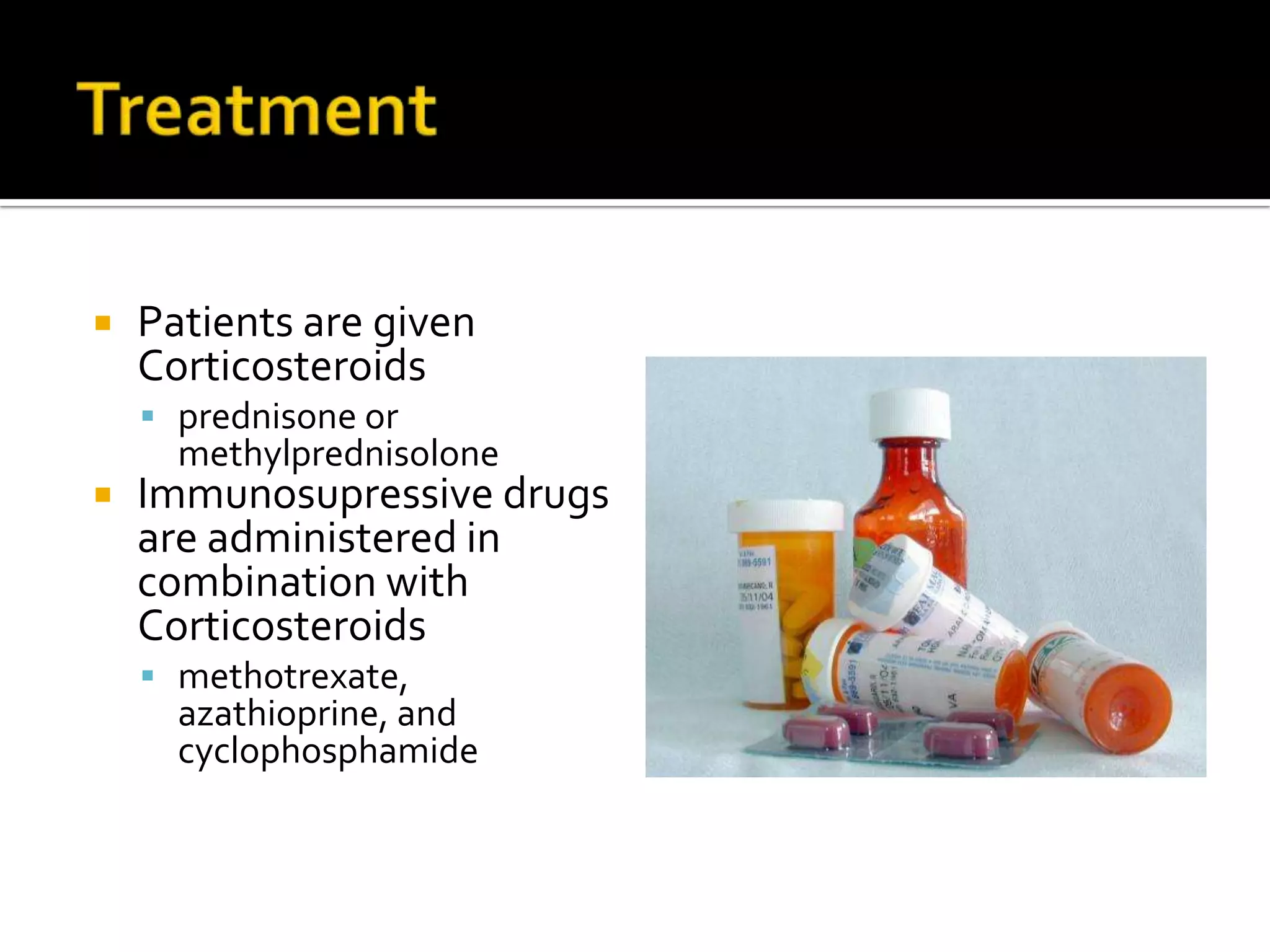 Treatment Patients are given Corticosteroids prednisone or methylprednisoloneImmunosupressive drugs are administered in combination with Corticosteroids methotrexate, azathioprine, and cyclophosphamide