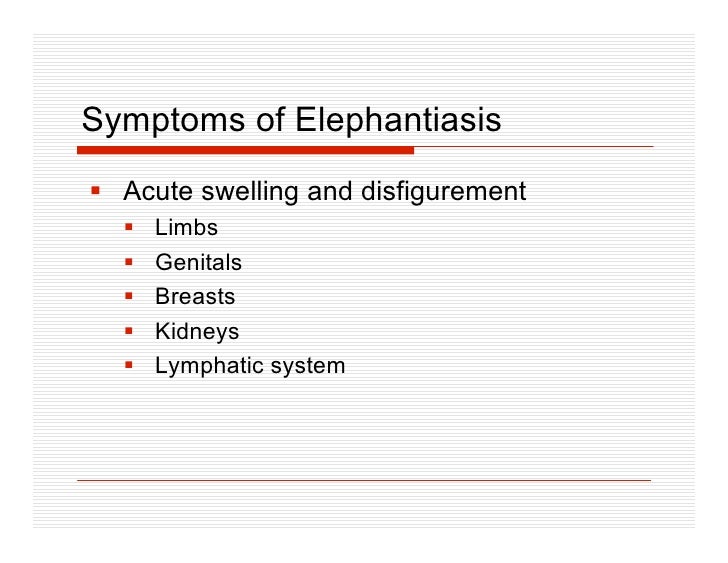 lymphatic system and elephantiasis overview elephantiasis To understand lymphoma, it helps to learn how the lymphatic system works. lymphatic system and elephantiasis overview elephantiasis To understand lymphoma, it helps to learn how the lymphatic system works.