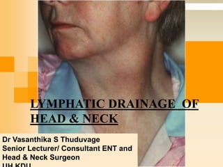 LYMPHATIC DRAINAGE OF
HEAD & NECK
Dr Vasanthika S Thuduvage
Senior Lecturer/ Consultant ENT and
Head & Neck Surgeon
 