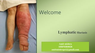 Welcome
Lymphatic filariasis
Amit mishra
18BPHR0028
amitmishrapci@gmail.com
 