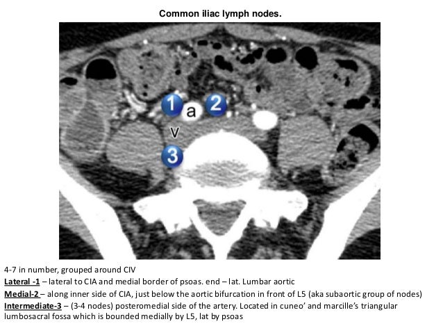 Lymphatics of the pelvis
