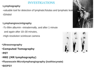 Lymphography
-valuable tool for detection of lymphaticfistulas and lymphatic leakage
-Ethidiol
Lymphangioscintigraphy
-Tc-99m albumin –intradermally, and after 1 minute
and again after 10–30 minutes,
-High-resolution scintiscan camera
•Ultrasonography
•Computed Tomography
•PET
•MRI (MR lymphography)
•Fluorescein Microlymphangiography (isothiocynate)
•BIOPSY
INVESTIGATIONS
 