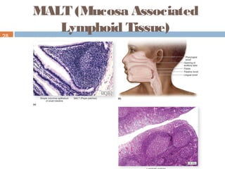 MALT (Mucosa Associated
Lymphoid Tissue)28
 
