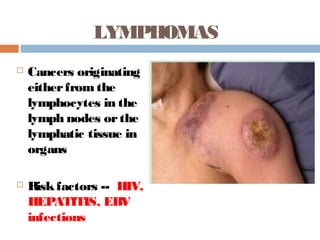 LYMPHOMAS
 Cancers originating
eitherfrom the
lymphocytes in the
lymph nodes orthe
lymphatic tissue in
organs
 Riskfactors -- HIV,
HEPATITIS, EBV
infections
 